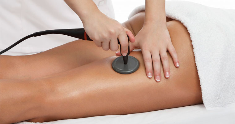 Radiofrecuencia Corporal