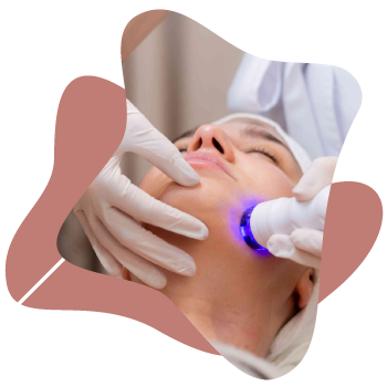 Tratamientos Faciales